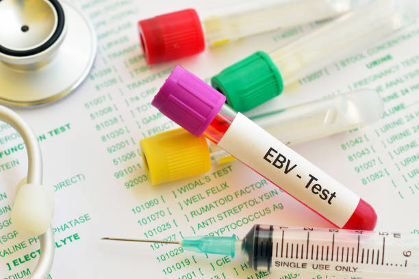 Epstein-Barr Virus (EBV) Reactivation: Symptoms, Treatment, Care