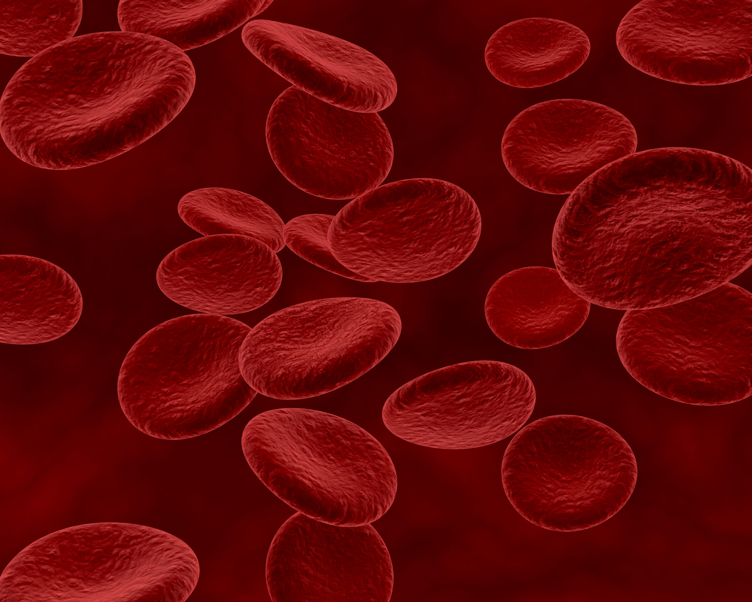 Vasculitis – Blood Vessel Inflammation & Organ Damage