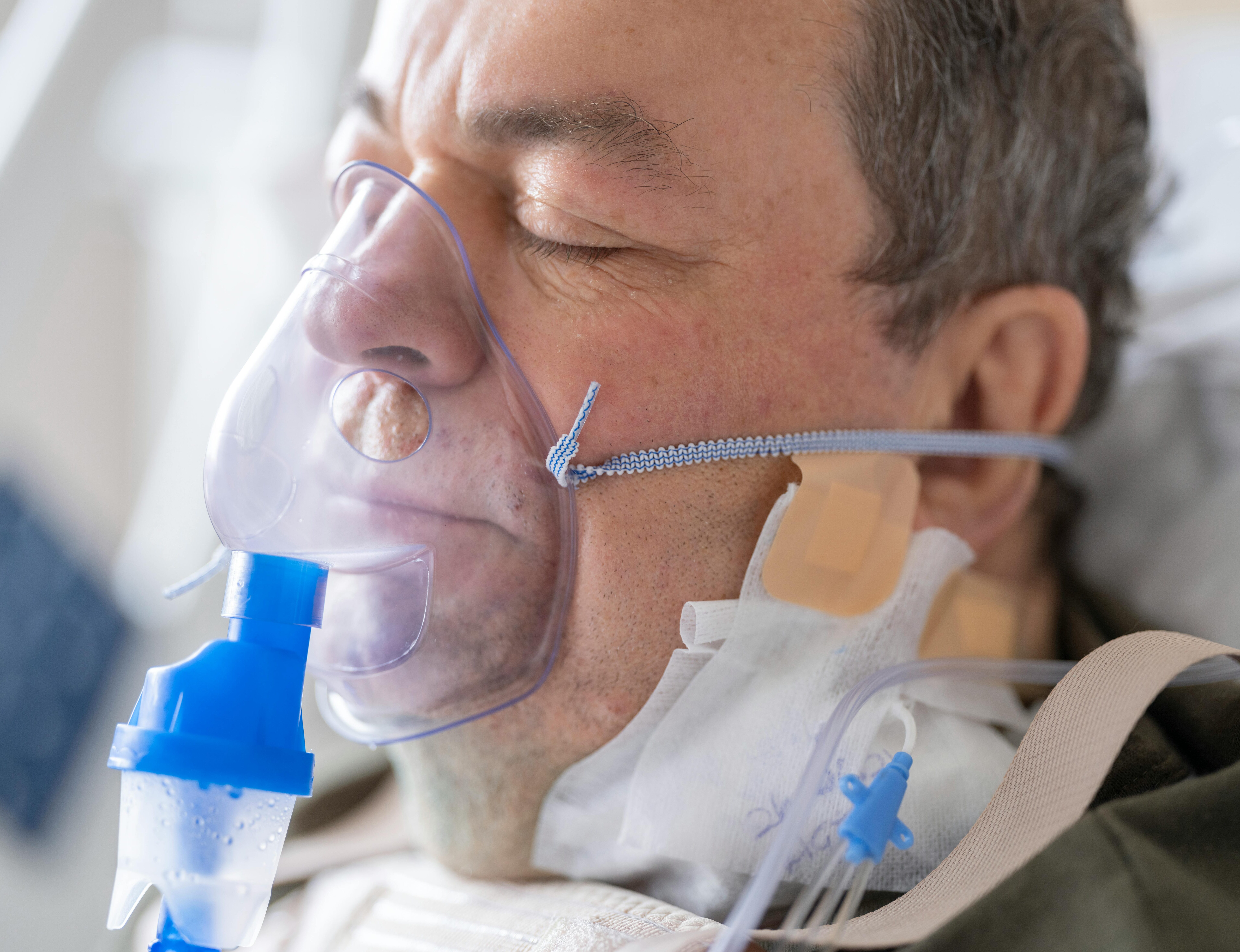 COPD